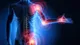 El dolor articular y artrosis: cómo enfrentarlos