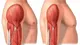 Salud integral: masa muscular, alimentación consciente y avances médicos