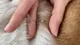 ¿Qué son esas “verrugas” que les salen a algunos perros?
