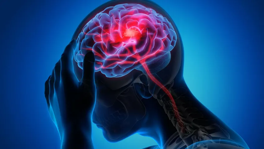 ¿Quién está en riesgo de tener un accidente cerebrovascular?